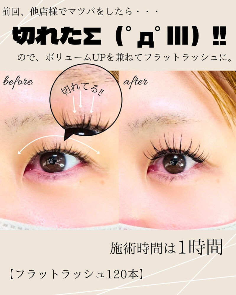 ブログ